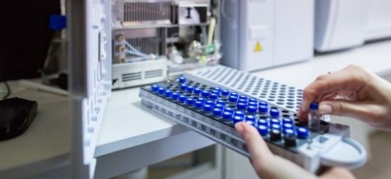Understanding the Difference Between GCMS and HPLC
